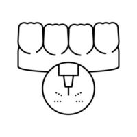 illustration vectorielle de l'icône de la ligne de traitement au laser des dents de stomatologie vecteur