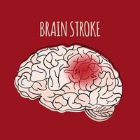 cerveau accident vasculaire cérébral insulter médicament santé vecteur illustration