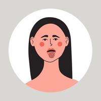 Jeune femme avec sec bouche et langue, xérostomie problème. vecteur