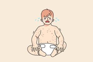 malheureux bébé bébé pleurs souffrir de eczéma ou dermatologie maladie. dérangé triste peu enfant nouveau née enfant stressé avec rougeole ou varicelle. les enfants soins de santé concept. vecteur illustration.