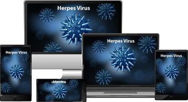virus de l'herpès sur différents écrans de gadgets vecteur