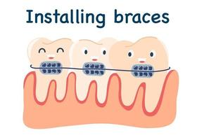 mignonne dessin animé les dents avec croisillons. installation croisillons. de bonne humeur Icônes. redressage dents. correction de octet. dentisterie. orthodontie. dentaire se soucier. métal croisillons. tout droit dents. vecteur illustration