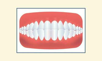 sous-occlusion les dents mâchoire icône plus de Jaune Contexte. vecteur