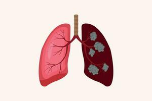 poumon cancer et Ordinaire poumon illustration comparaison. eps dix. icône ensemble vecteur
