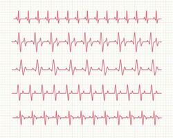 cœur rythme graphique vérification votre battement de coeur pour diagnostic vecteur