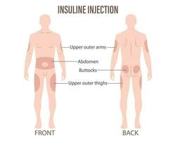 diabète. insuline injection des sites sur le Humain corps, plus haut bras, abdomen, fesses, plus haut cuisses. médical infographie bannière, affiche vecteur