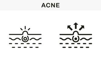 peau acné, point noir, comédon ligne et silhouette noir icône ensemble. bouton et inflammation sébum pictogramme. Profond sale pore, peau problème symbole collection. isolé vecteur illustration.