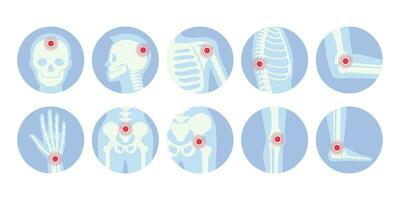 Humain squelette douleur points icône ensemble vecteur plat illustration