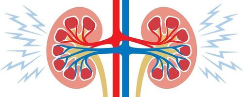concept de problème de rein humain vecteur
