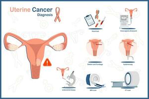 plat médical vecteur illustration concept de utérin cancer.utérus et utérin cancer diagnostic.sang test, ct scanner, IRM scan, échographie, endomètre biopsie, hystéroscopie, dilatation et curetage.