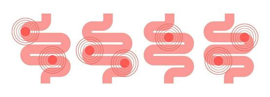 ensemble de estomac images avec problèmes. hypersensibilité à Composants de le nourriture vecteur