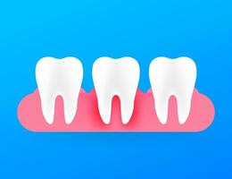 gencive maladie, parodontite. en bonne santé blanc dent. vecteur Stock illustration