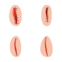 chirurgical suture Icônes ensemble dessin animé vecteur. divers type de en fonctionnement suture vecteur