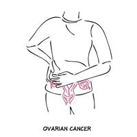 ligne art vecteur de ovaire cancer ouvrages d'art. ovaire cancer clipart