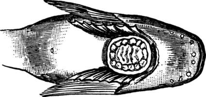 escargot ventouse entre le pectoral nageoires, ancien illustration. vecteur