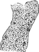nuageux gonflement de le épithélium garniture une un rein tubule, ancien gravure. vecteur