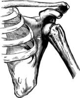 dislocation de le humérus, ancien illustration. vecteur