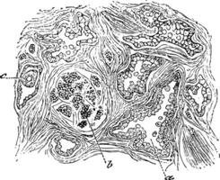 section de le prostate glande, ancien illustration. vecteur