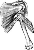 fracturé humérus, ancien illustration. vecteur