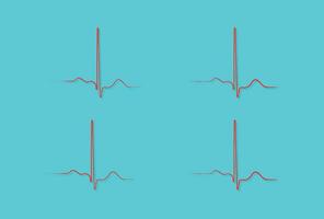 ventriculaire repolarisation, cardiaque cycle, ecg de cœur dans Ordinaire sinus rythme, qt intervalle de ECG. vecteur