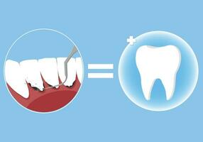 professionnel les dents nettoyage vecteur illustration. livre un rendez-vous pour les dents nettoyage