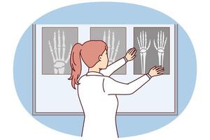 femme chirurgien s'applique radiographie de main à lumineux planche à voir des sites de OS fracture. vecteur image