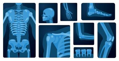 X rayon corps les pièces. Humain squelette le genou bras poitrine poignet pied, médical radiographie imagerie concept de OS blessure. vecteur plat ensemble