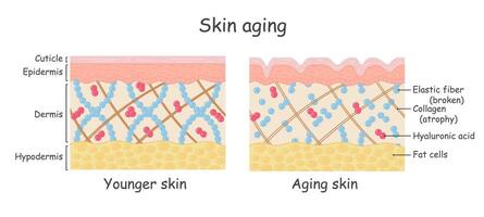 vecteur diagramme avec schémas de deux les types de peau, pour soins de santé des illustrations