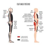 plat retour posture. le côté vue spectacles caractéristique diminution Naturel courbes de colonne vertébrale, bassin rotation, étiré et affaibli, raccourci et dizaines muscles. vecteur