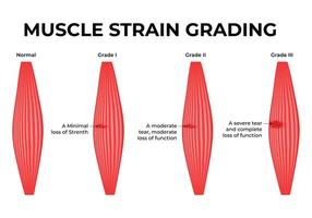 muscle souche classement science conception illustration diagramme vecteur