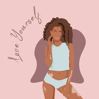 jeune femme afro-américaine avec vitiligo debout. aime toi toi-même. journée mondiale du vitiligo le 25 juin. vecteur