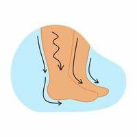 gonflement des pieds et des jambes humains. illustration vectorielle sur le thème de la médecine. vecteur