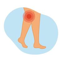 arthrose de l'articulation du genou. illustration vectorielle des jambes avec inflammation dans la région du genou. maladies du système musculo-squelettique. vecteur