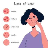 tableau des types d'acné vecteur