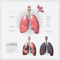 Poumon avec détail et illustration vectorielle de cancer du poumon