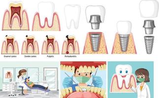 ensemble de tous les types de dents sur fond blanc vecteur