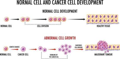 schéma montrant les cellules normales et cancéreuses vecteur