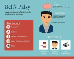 infographie sur la paralysie des cloches pour en montrer la cause et le symptôme vecteur