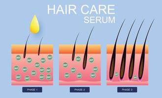 sérum de soins capillaires, greffe de cheveux, conception vectorielle vecteur