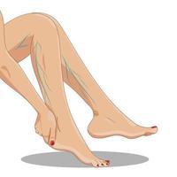 varicosité. jambes féminines fatiguées assises, vue latérale, avec varices, une main au-dessus de la cheville. vecteur
