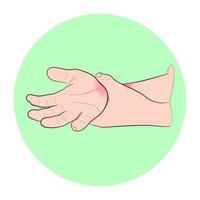 graphiques d'image contours vectoriels la douleur au poignet est souvent causée par des entorses ou des fractures dues à des blessures soudaines concept de soins de santé vecteur
