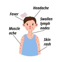 infographie des symptômes du virus monkeypox sur un enfant patient souffrant de fièvre, de maux de tête, de ganglions lymphatiques enflés, d'éruptions cutanées sur le visage, le corps et le dos, de douleurs musculaires. illustration vectorielle isolée à plat pour impression. vecteur