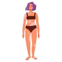 femmes atteintes de vitiligo en maillot de bain. femmes positives pour le corps. journée mondiale du vitiligo. maladie de peau maladies rares. illustrations vectorielles plates vecteur