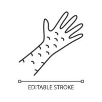 éruption cutanée, icône linéaire de dermatite de contact. illustration de fine ligne d'irritation. rubéole, symptôme de la rougeole. urticaire, eczéma, symbole de contour du psoriasis. dessin de contour isolé de vecteur. trait modifiable vecteur