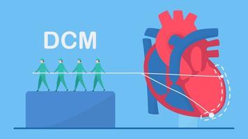 concept de cardiomyopathie dilatée avec ventricule gauche élargi vecteur