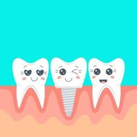 dents kawaii, implantation et dentisterie. bannière avec espace de copie. illustration de stock de vecteur. vecteur