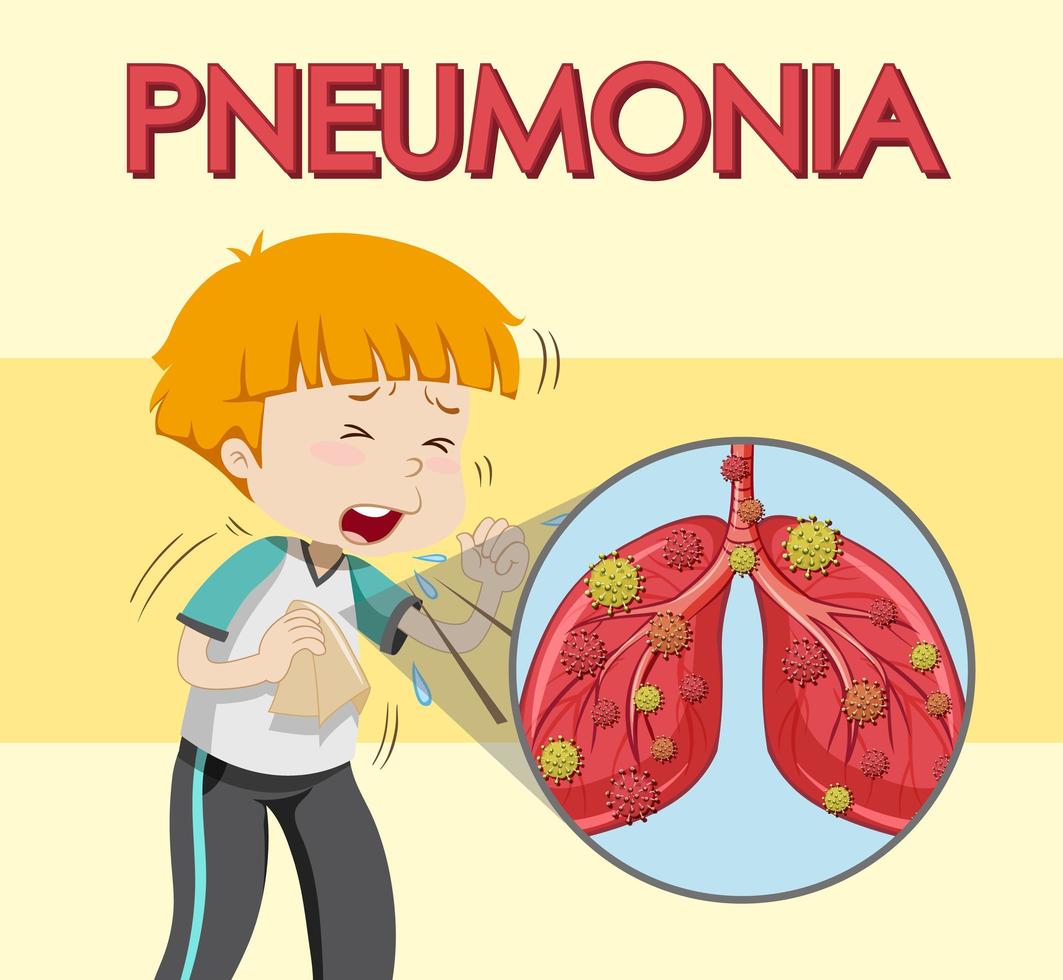 design de cartaz para pneumonia com tosse de menino vetor