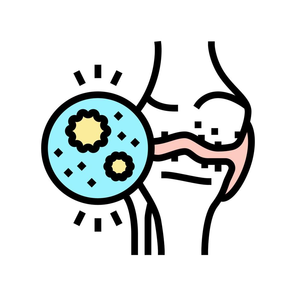ilustração vetorial de ícone de cor de artrite infecciosa vetor