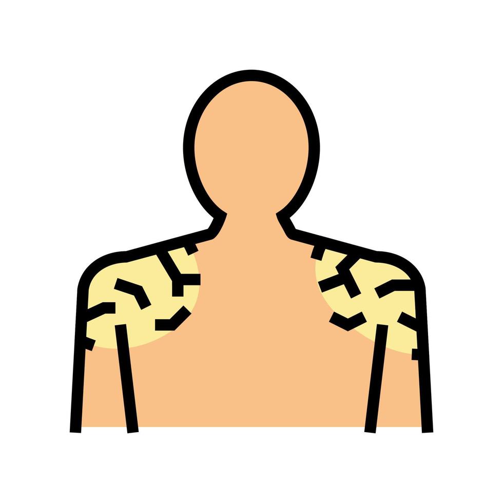 ilustração vetorial de ícone de cor de pele seca de ombros vetor