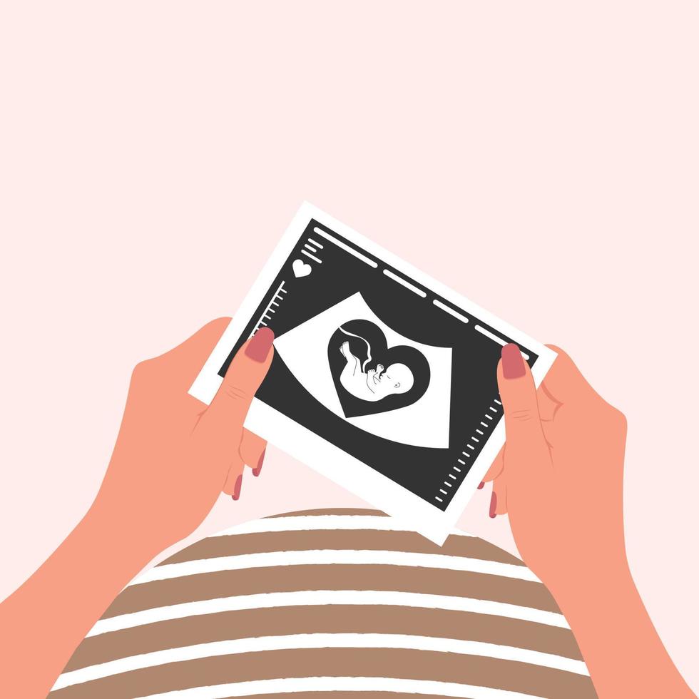 uma mulher grávida feliz segura uma fotografia de uma ultrassonografia fetal em ambas as mãos. imagem de ultra-som do bebê. vetor